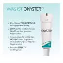 Onyster Nagelset - Onyster Nagelset
