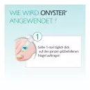Onyster Nagelset - Onyster Nagelset