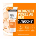 Ежедневное увлажняющее средство от прыщей Neutrogena - Ежедневное увлажняющее средство от прыщей Neutrogena