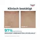Клинический обновляющий лосьон для тела Eucerin DermoPure - Клинический обновляющий лосьон для тела Eucerin DermoPure